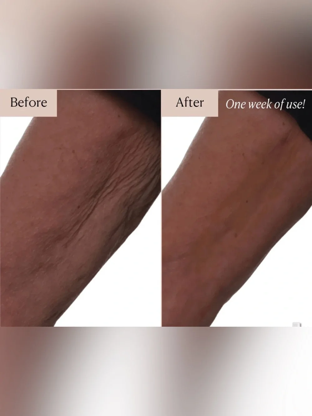 Nakery Beauty 💛 Lift-TOX 💛moisturizing Body Lifting & Tightening Treatment